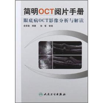 简明OCT阅片手册：眼底病OCT影像分析与解读  