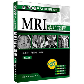 [PDF电子书] 影像读片从入门到精通系列：MRI读片指南   电子书下载 PDF下载