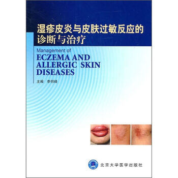 [PDF电子书] 湿疹皮炎与皮肤过敏反应的诊断与治疗   电子书下载 PDF下载