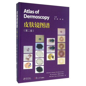 皮肤镜图谱（第二版） [Atlas Of Dermoscopy]