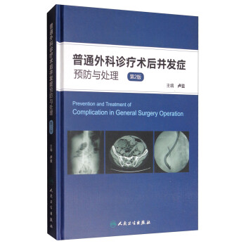 普通外科诊疗术后并发症预防与处理（第2版） [Prevention and Treatment of Complication in General Surgery Operation]