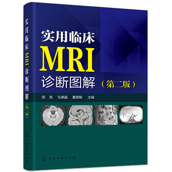 实用临床MRI诊断图解（第二版）