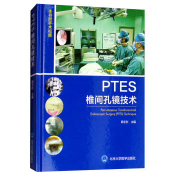 PTES椎间孔镜技术（附手术视频） [Percutaneous Transforaminal Endoscopic Surgery（PTES）Technique]