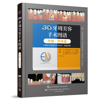 3D牙周美容手术图谱：种植·桥体篇 [3D-Illustrated Periodontal Plastic Surgery]