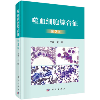 噬血细胞综合征（第2版） 下载