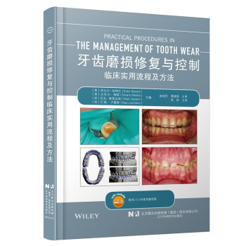 牙齿磨损修复与控制临床实用流程及方法