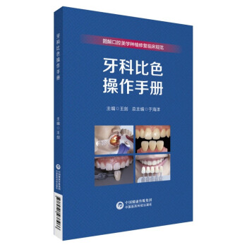 牙科比色操作手册（图解口腔美学种植修复临床实操规范丛书） 下载