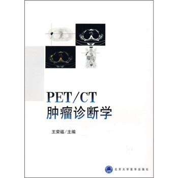 PET/CT肿瘤诊断学 下载