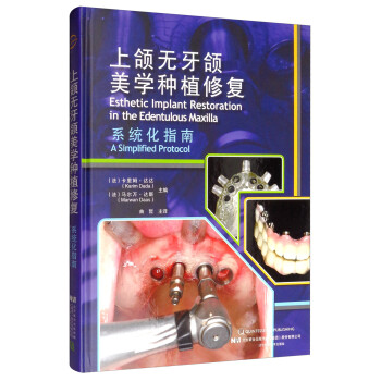 上颌无牙颌美学种植修复系统化指南 [Esthetic Implant Restoration in the Edentulous Maxilla：A Simplified Protocol]
