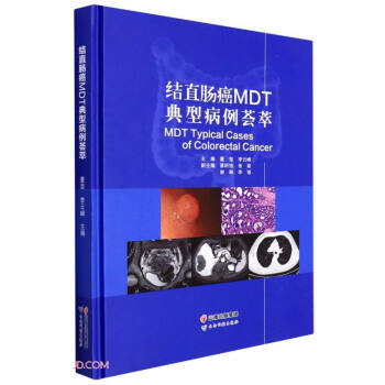结直肠癌MDT典型病例荟萃(精)