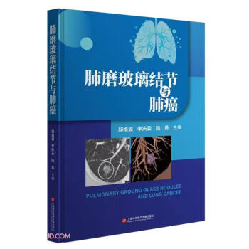 肺磨玻璃结节与肺癌 关于肺结节和肺癌，你应该知道的医学知识