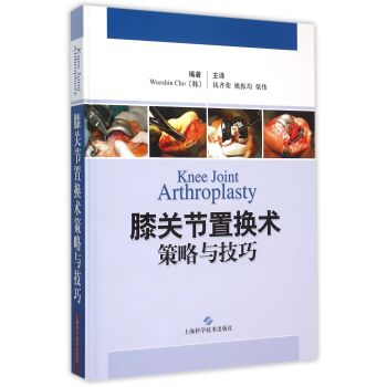 膝关节置换术策略与技巧 下载