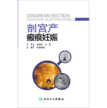 剖宫产瘢痕妊娠 下载