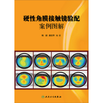 硬性角膜接触镜验配案例图解 下载