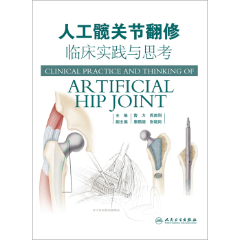 人工髋关节翻修临床实践与思考 下载