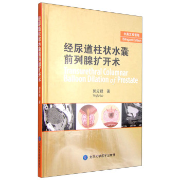 经尿道前列腺扩开术 下载