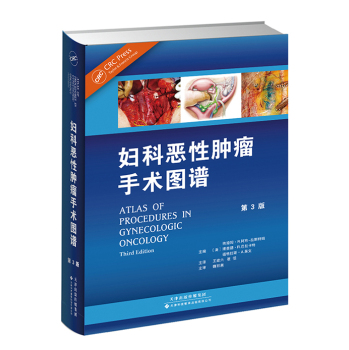 妇科恶性肿瘤手术图谱 下载
