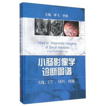 小肠影像学诊断图谱：X线、CT、MRI、内镜 下载