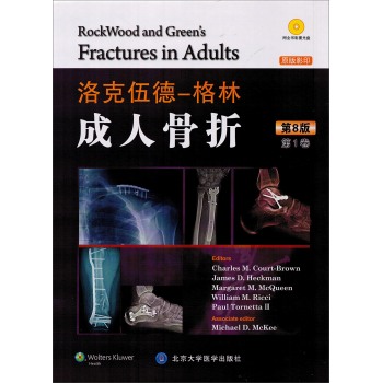 洛克伍德-格林 成人骨折 下载