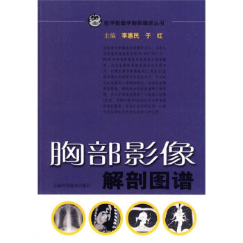胸部影像解剖图谱   下载
