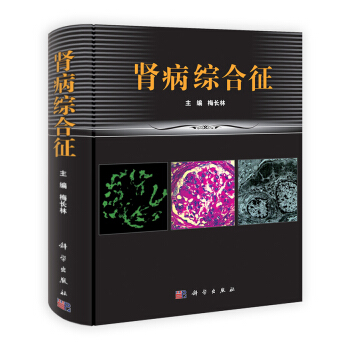 肾病综合征 下载