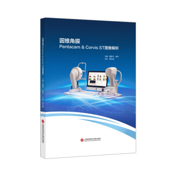 圆锥角膜Pentacam&Corvis ST图像解析 下载