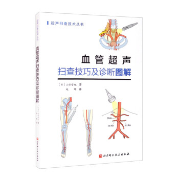 血管超声扫查技巧及诊断图解 下载