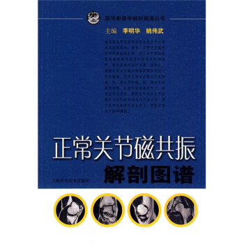 正常关节磁共振解剖图谱 下载