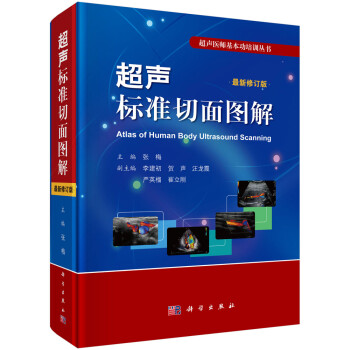 超声标准切面图解（修订版） 下载