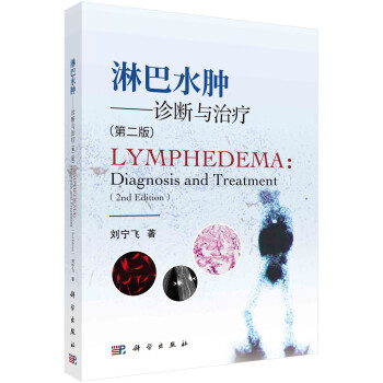 淋巴水肿——诊断与治疗（第二版） 下载