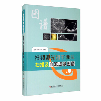 扫频源光相干断层扫描及血流成像图谱 下载