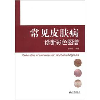 常见皮肤病诊断彩色图谱 下载