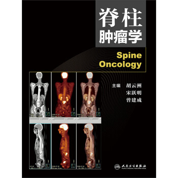 脊柱肿瘤学 下载