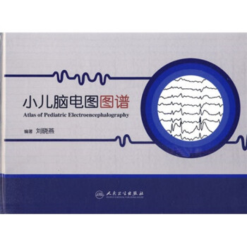 小儿脑电图图谱 下载
