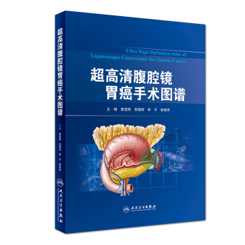 超高清腹腔镜胃癌手术图谱 下载