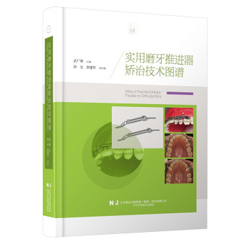 实用磨牙推进器矫治技术图谱 下载