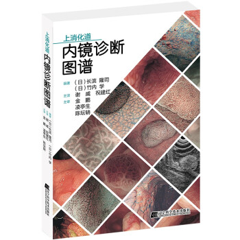 上消化道内镜诊断图谱 下载