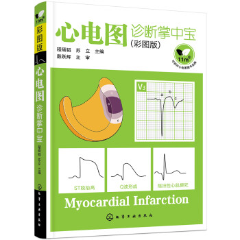 心电图诊断掌中宝（彩图版）（全彩图解） 下载