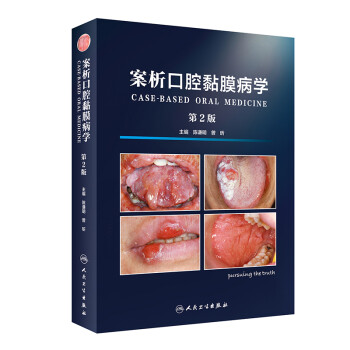 案析口腔黏膜病学（第2版） 下载