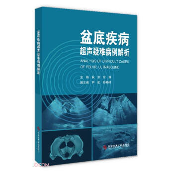 盆底疾病超声疑难病例解析 下载