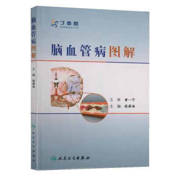 脑血管病图解 下载