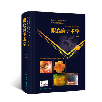 眼底病手术学（第2版/配增值） 下载