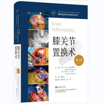 膝关节置换术（第4版） 下载