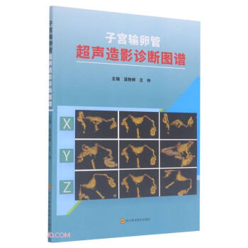 子宫输卵管超声造影诊断图谱 下载