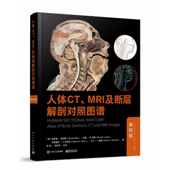 人体CT、MRI及断层解剖对照图谱（第四版） 下载