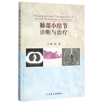 肺部小结节诊断与治疗 下载