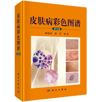 皮肤病彩色图谱 下载