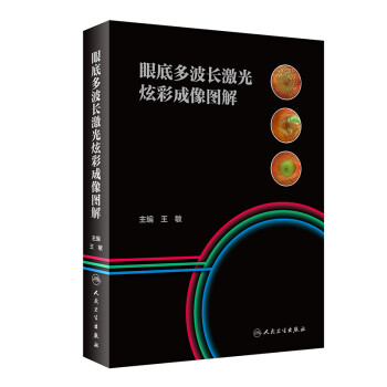 眼底多波长激光炫彩成像图解 下载