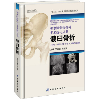 积水潭创伤骨科手术技巧：髋臼骨折 下载