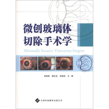 微创玻璃体切除手术学 [Minimally Invasive Vitrectomy Surgery] 下载
